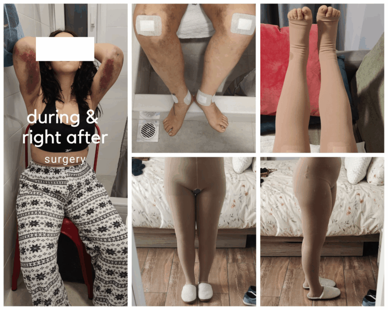 during and after right surgery min 768x614