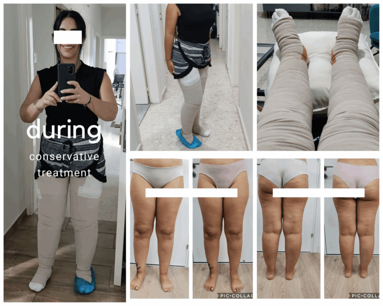 during conservative treatment min 768x614